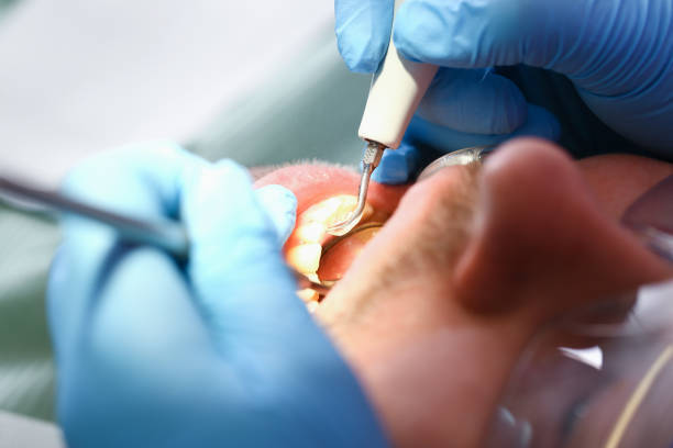 Best Walk-In Emergency Dentist in Lakeport, TX